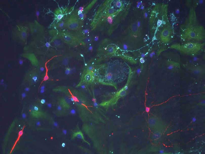 When stem cells from the old brain are cultured with signals of a young choroid plexus they can divide and form new neurons (red). © Biozentrum, University of Basel